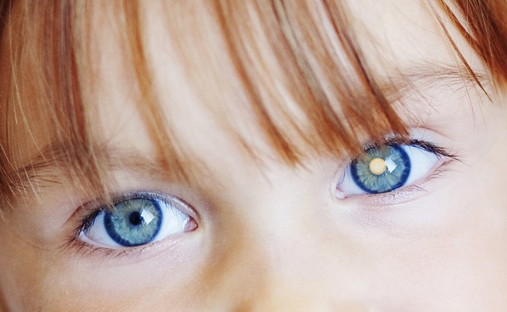 See the light - early detection of eye cancer in children